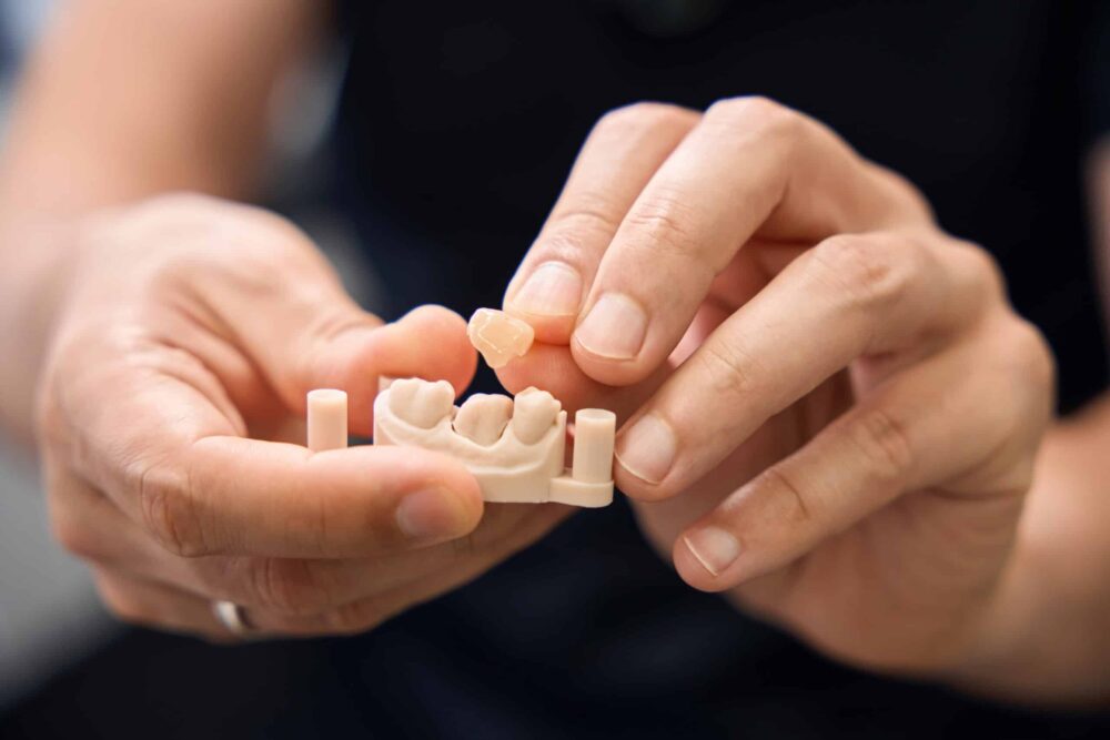Dental Crowns Ardmore