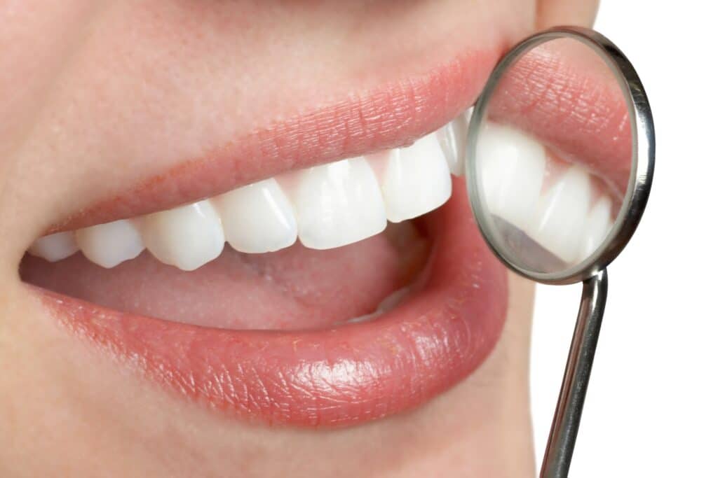 Dental Cleanings Ardmore